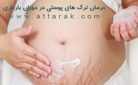 درمان ترک های پوست دوران بارداری