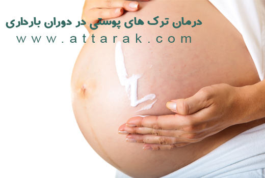 درمان ترک های پوست دوران بارداری