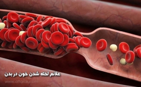 علائم لخته شدن خون در بدن