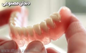 دندان پروتز دندان و روش های انتخاب آن