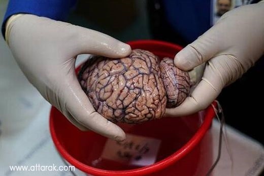 مغز انسان چگونه کار می کند ؟