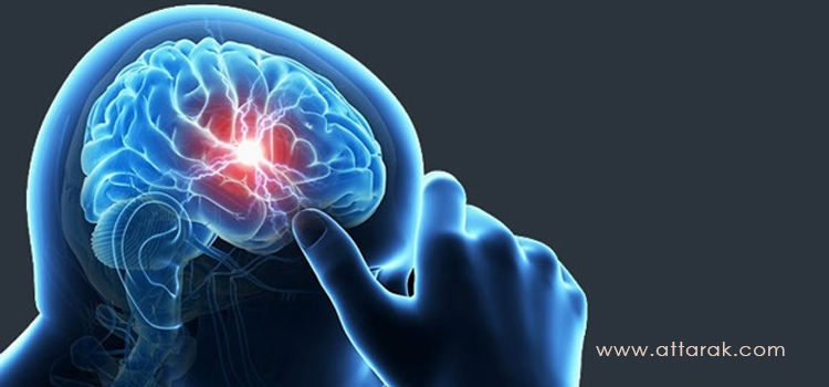 چه چیزی باعث آبسه مغز می شود؟
