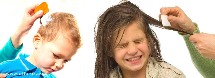 ناهنجاری های پوست و مو در کودکان