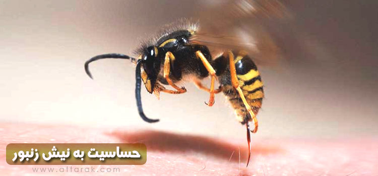 حساسیت به نیش زنبور و روش های درمانش