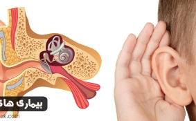بیماری های گوش داخلی و شنوایی