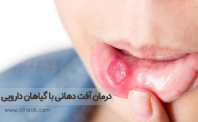 درمان آفت دهانی با گیاهان دارویی