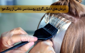 درمان های خانگی آلرژی پوست سر، ناشی از رنگ مو