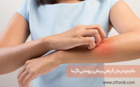 علایم و درمان گیاهی بیماری پوستی اگزما