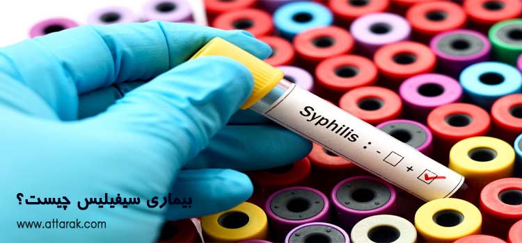 بیماری سیفیلیس (Syphilis) چیست؟
