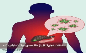 بیماری هپاتیت