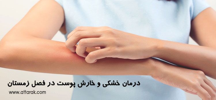 درمان خشکی و خارش پوست در فصل زمستان 