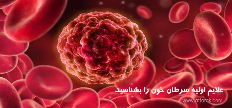 علایم اولیه سرطان خون را بشناسید