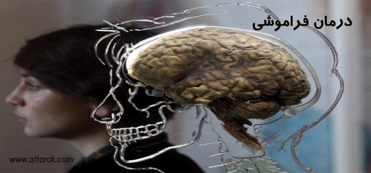 درمان فراموشی و تقویت حافظه در طب سنتی ایران 