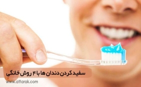 سفید کردن دندان ها با 4 روش خانگی