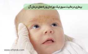 بیماری درماتیت سبورئیک نوزادان و راه های درمان آن