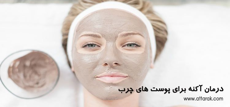 درمان آکنه برای پوست های چرب با ماسک های خانگی