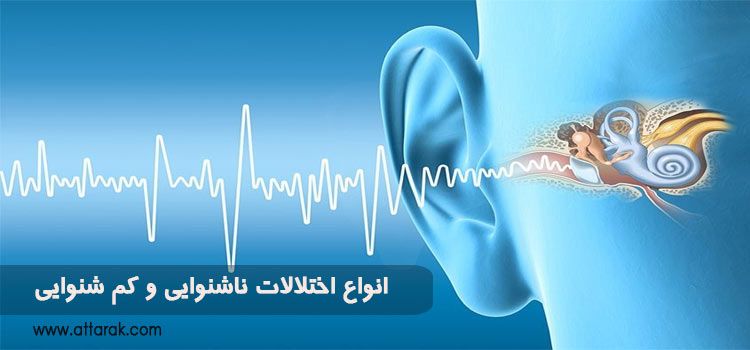 معرفی انواع اختلالات ناشنوایی و کم شنوایی