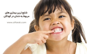 بیماری های مربوط به دندان در کودکان