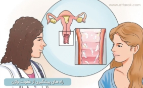 راه های پیشگیری از عفونت واژن