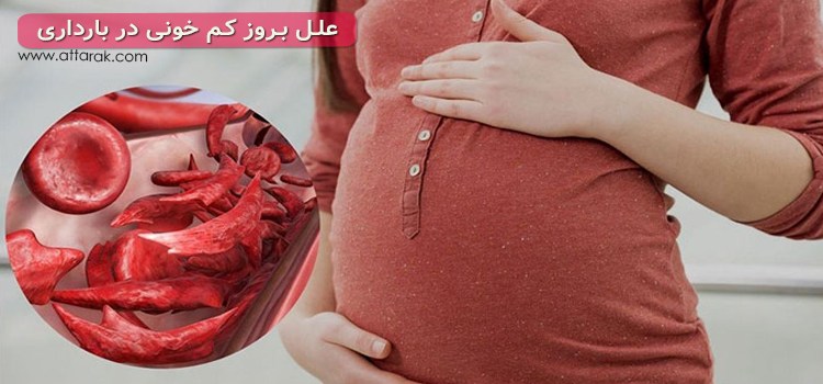 آشنایی با علائم و عوارض کم خونی در بارداری + علل ایجاد آن