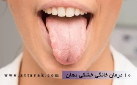 10 درمان خانگی خشکی دهان