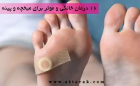 16 درمان خانگی و موثر برای میخچه پا و پینه پا