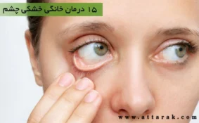 15 درمان خانگی خشکی چشم و نکاتی برای جلوگیری از آن