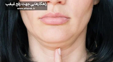 راهکارهایی جهت رفع غبغب
