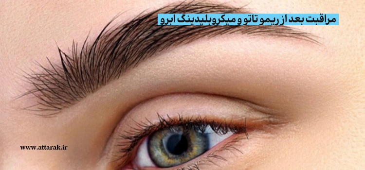 مراقبت بعد از ریمو تاتو و میکروبلیدینگ ابرو