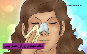 نکات مهم در روز اول عمل بینی