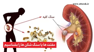 مفتت‌ ها یا سنگ شکن ها را بشناسیم