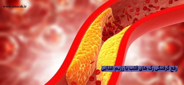 رفع گرفتگی رگ های قلب با رژیم غذایی