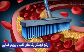 رفع گرفتگی رگ های قلب با رژیم غذایی