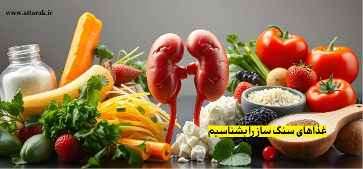 غذاهای سنگ ساز را بشناسیم