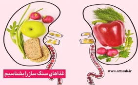 غذاهای سنگ ساز را بشناسیم