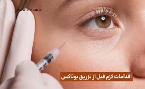 اقدامات لازم قبل از تزریق بوتاکس