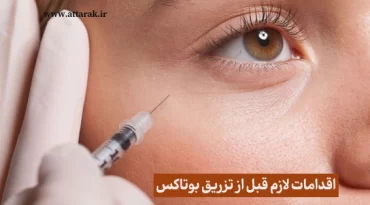 اقدامات لازم قبل از تزریق بوتاکس