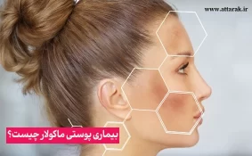 بیماری پوستی ماکولار